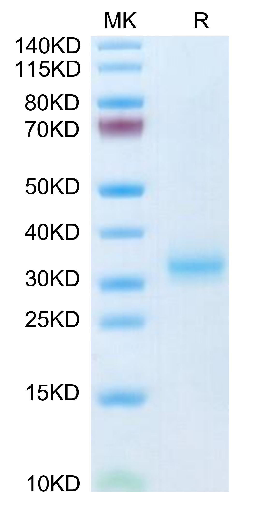 Mouse Adiponectin/Acrp30 Protein (ADI-MM101) – KACTUS