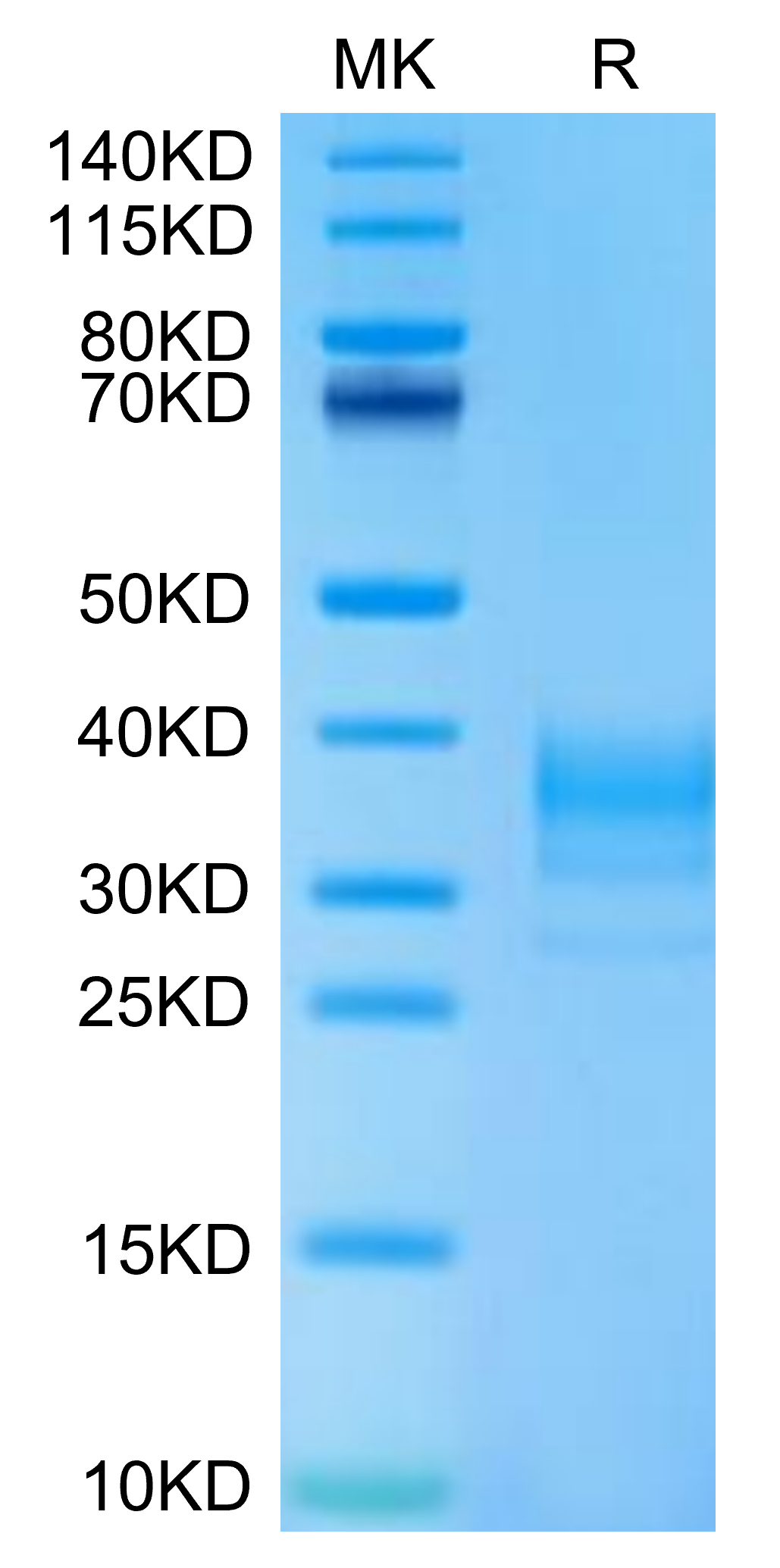 Human LAMP5 Protein (LAM-HM105) – KACTUS