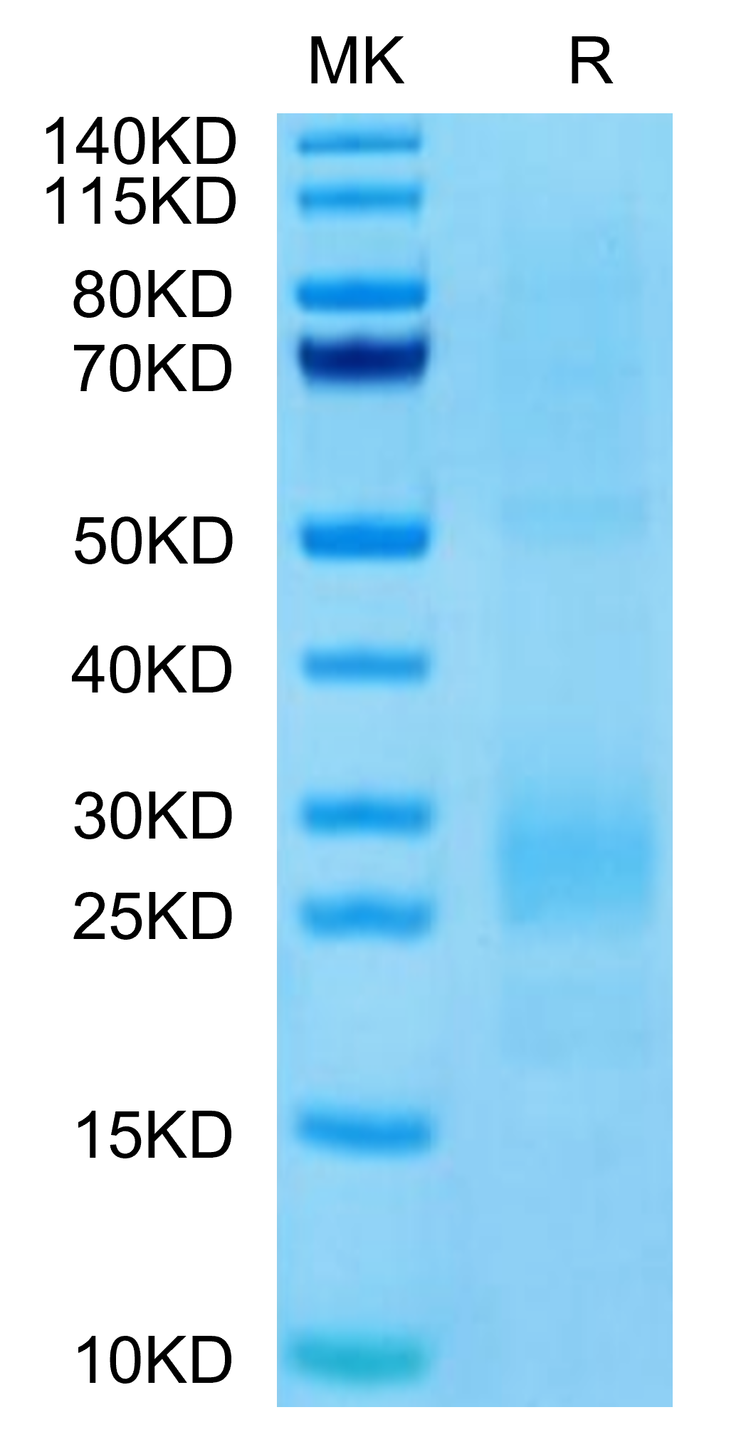 Human MIF Protein (MIFHM101) KACTUS