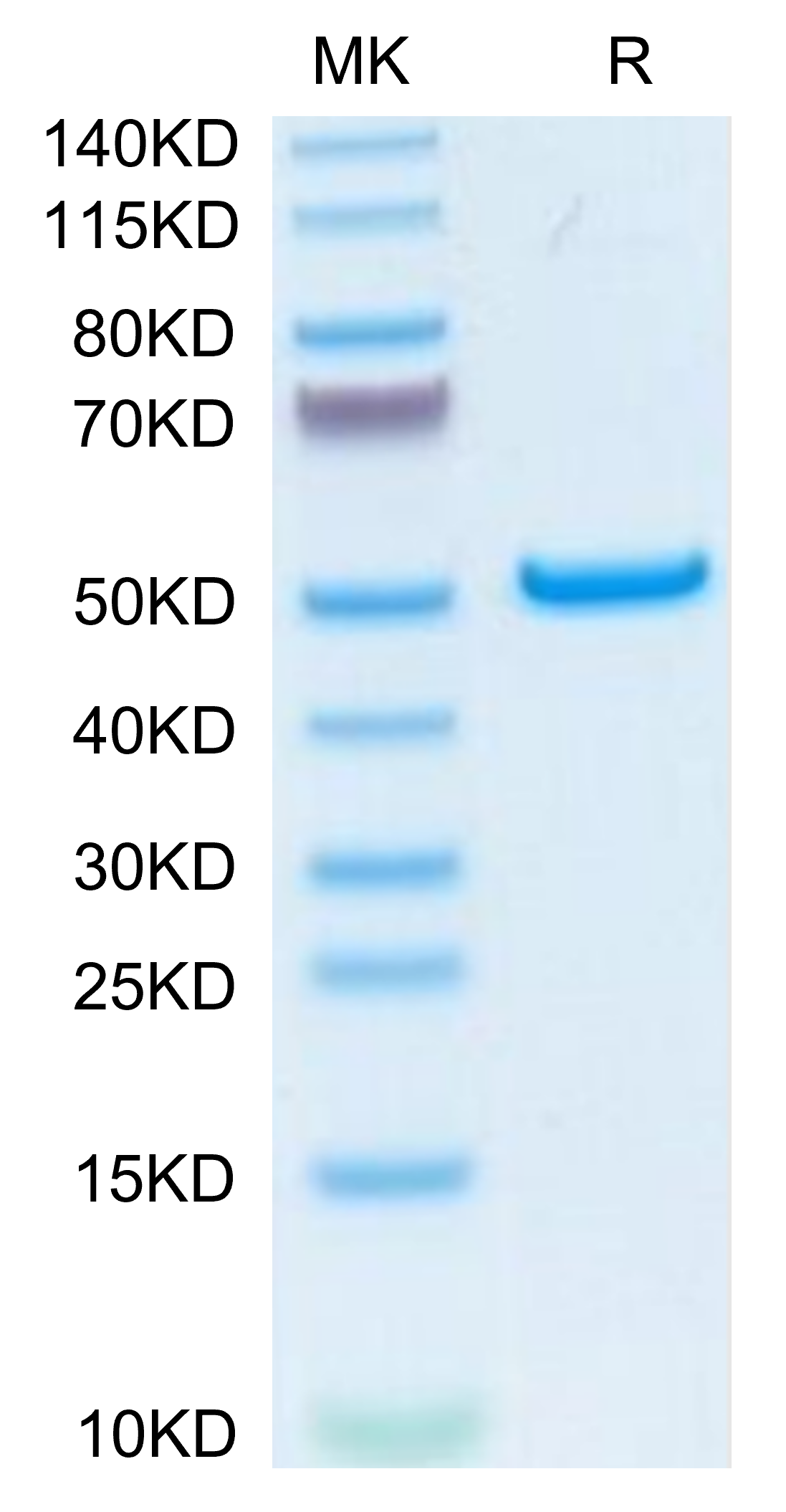 Human PLA2G1B Protein (PLA-HM21B) – KACTUS