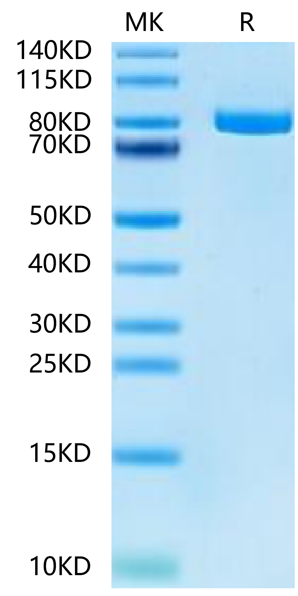 Mouse Transferrin R/CD71 Protein (TFR-MM101) – KACTUS